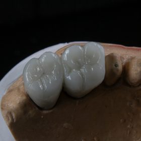 protetica dentara