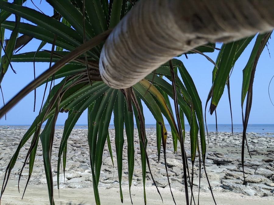 Palm itching
