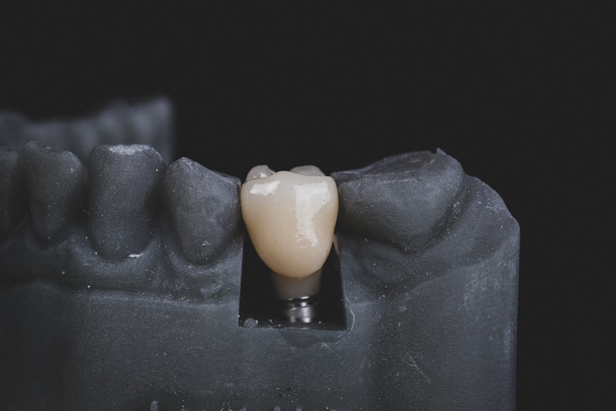 Tooth falling