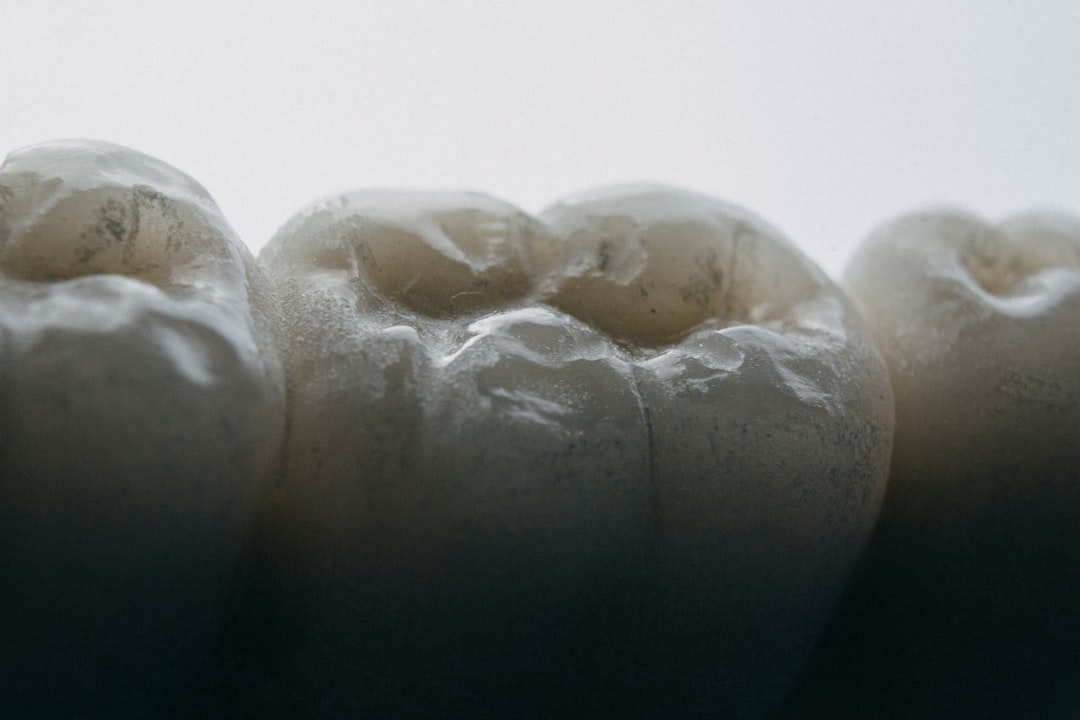 Photo Tooth falling out