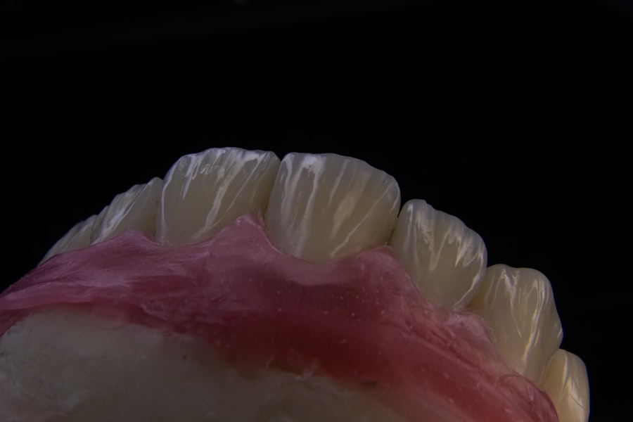 Photo Tooth falling out