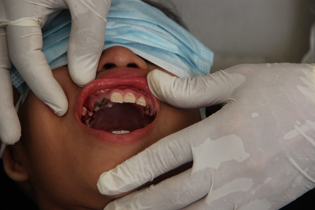 Photo Tooth falling