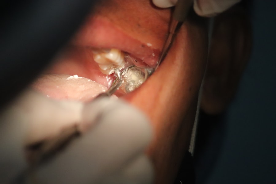 Photo Tooth falling