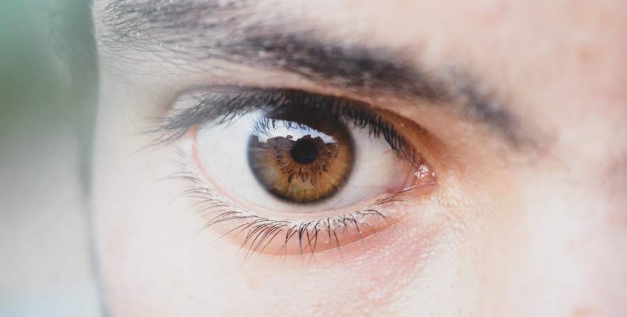 Photo Eye twitching