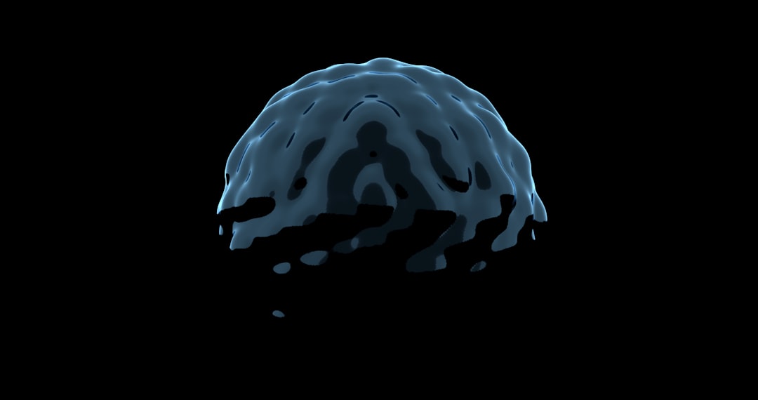 Photo Brain scan
