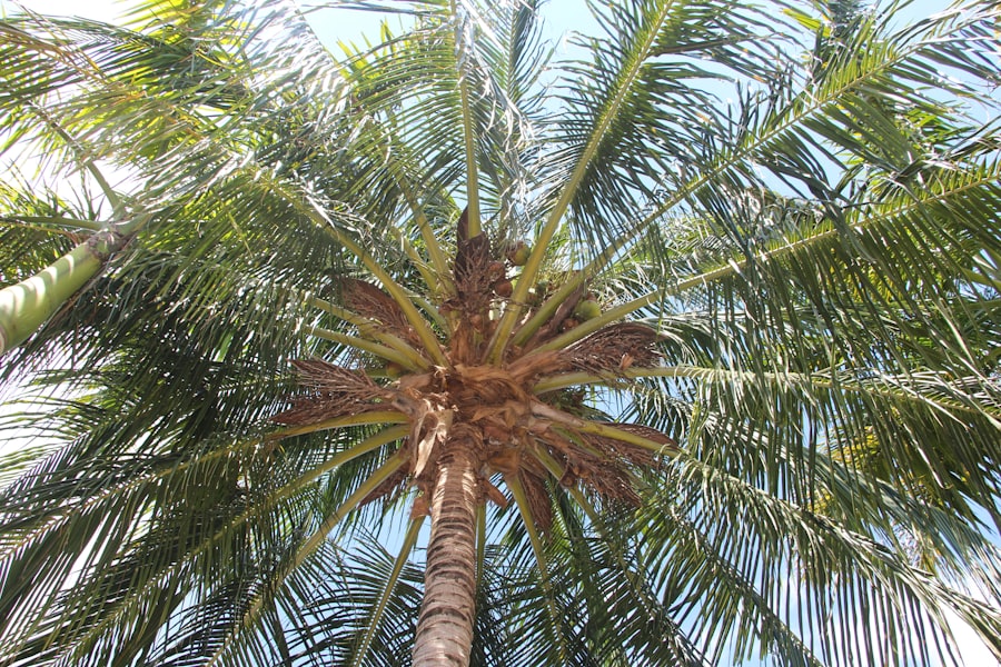 Photo Palm itching